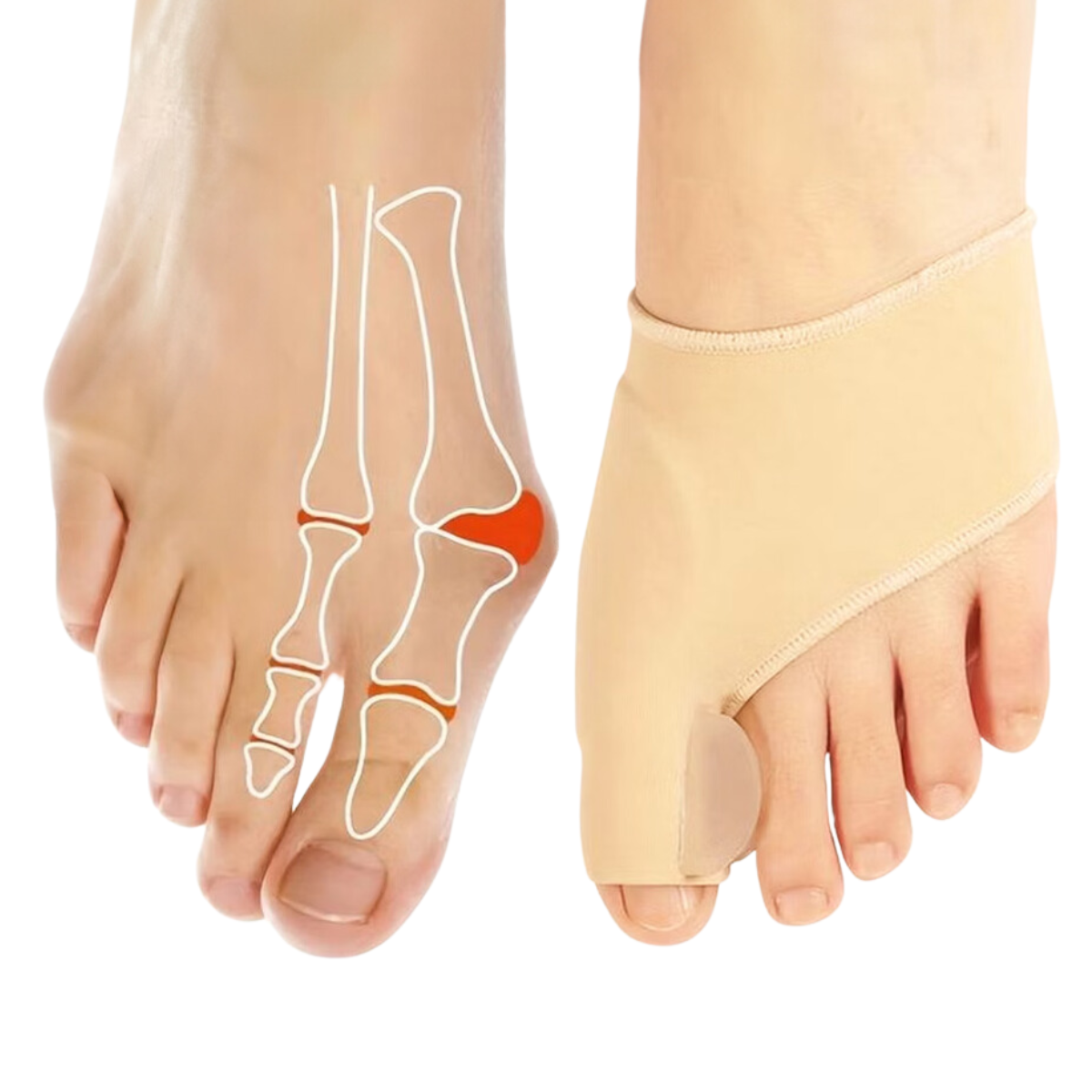 Hallux valgus korrigerende støtte med tåseparatør (2 stk)