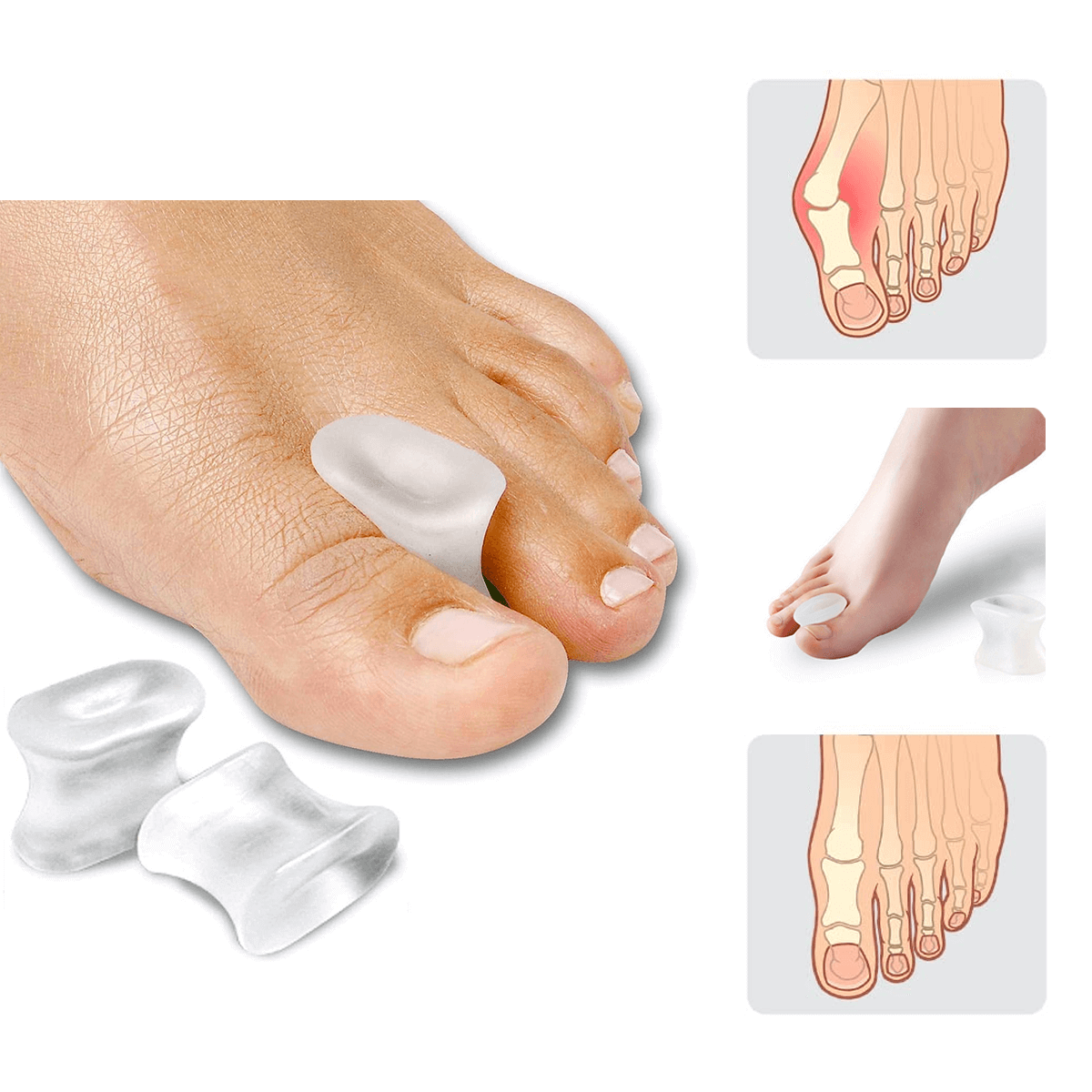 Tåseparator hallux valgus (2 stk)
